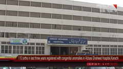 Karachi- In Last 3 Years 115 Children With Birth Defect Registered.